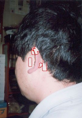 2002.3.24.chiryo1-1-1.jpg (50378 バイト)