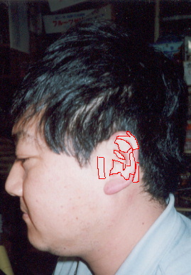2002.3.24.chiryo1-2-1.jpg (53781 バイト)
