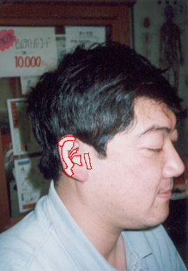 2002.3.24.chiryo1-3-1.jpg (49800 バイト)