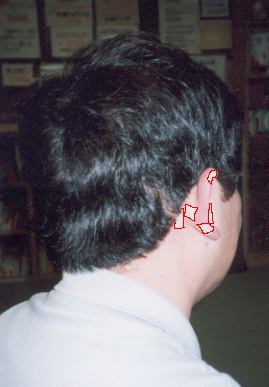 2002.3.24.chiryo1-4-1.jpg (46094 バイト)